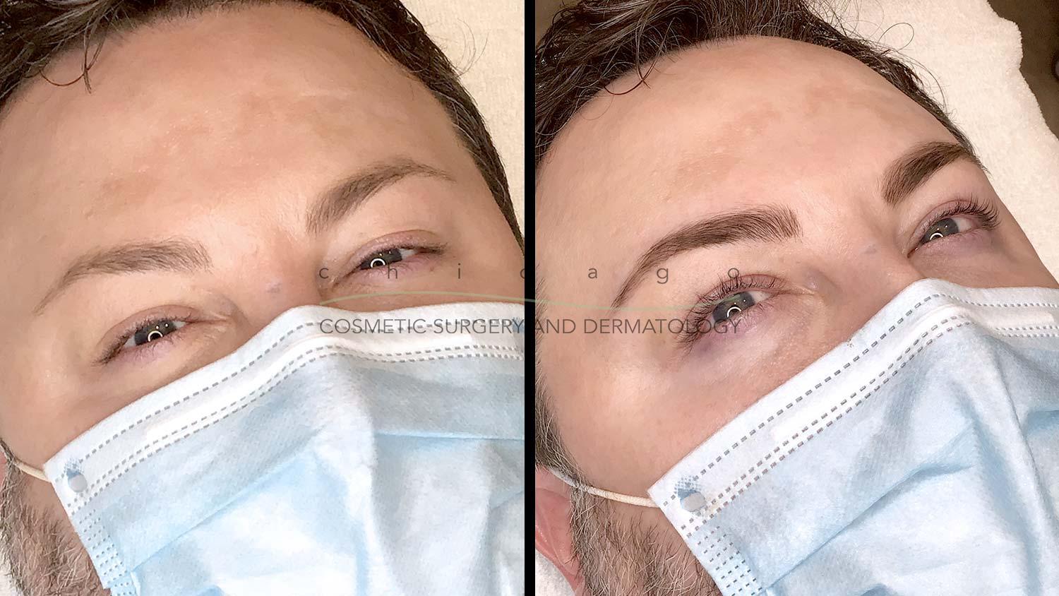 eyelash lift and tint before and after