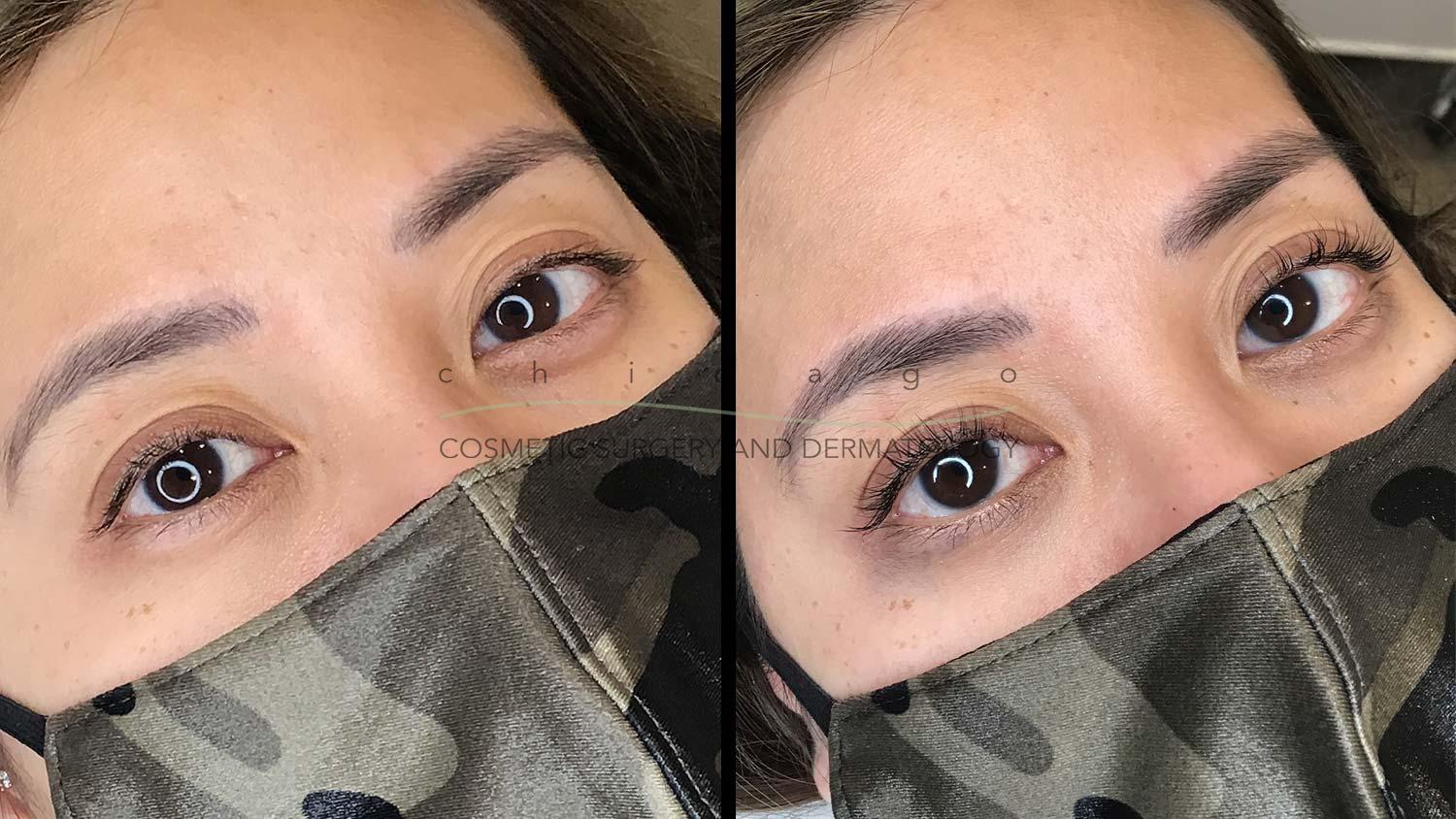 eyelash lift and tint before and after