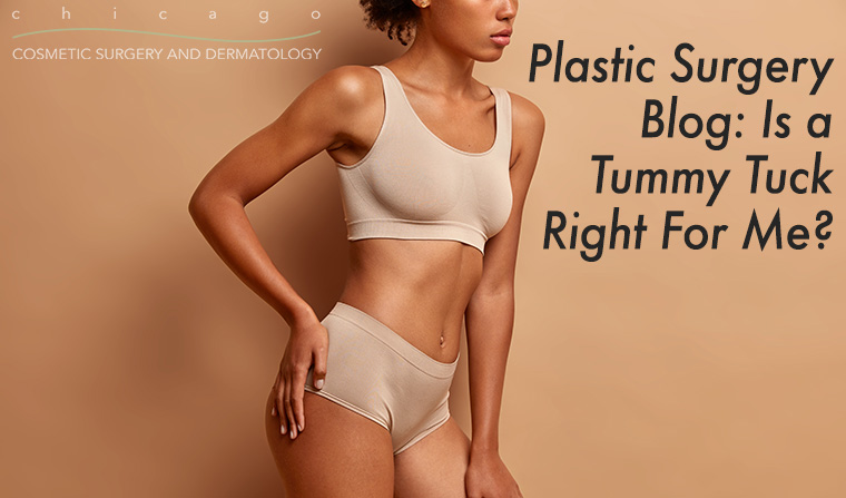Is a Tummy Tuck Right For Me?