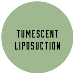 tumescent-liposuction